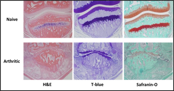 Rheumatoid Arthritis (RA) of monkey Rheumatoid Arthritis (RA) of monkey