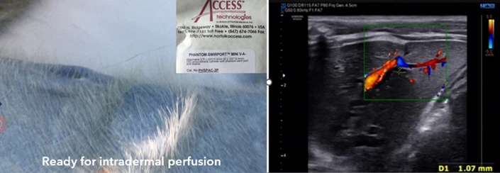 Injection into target organs/sites through catheter ports Injection into target organs/sites through catheter ports