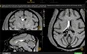Injeksi NHP Intracerebroventrikular (ICV)|Prisys Bioteknologi