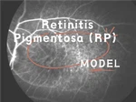Model NHP Retinitis Pigmentosa (RP).